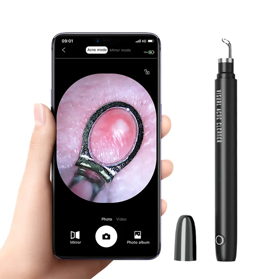 Батга цэвэрлэх камертай төхөөрөмж  /Pore Cleaner With HD Camera, Smart Visual Blackhead Remover/