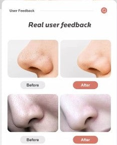 Нүүрний батга цэвэрлэх төхөөрөмж (Blackhead Remover Vacuum Instrument Facial Deep Cleansing Care Machine)